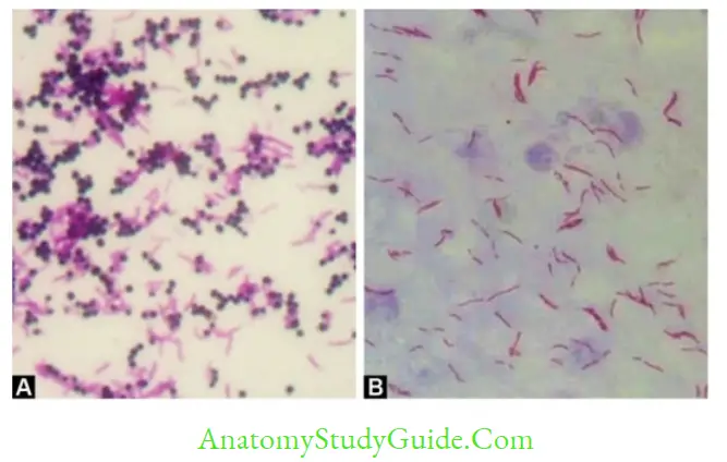 History, Taxonomy, Morphology and Physiology of Bacteria and Microbial Pathogenicity Gram staining demonstrating violet-colored gram-positive cocci in clusters and pink colored gram