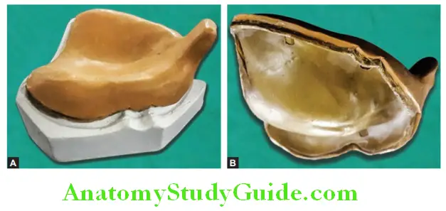 Impression Trays maxillary custom tray fabricated with shellac and reinforced with impression compound