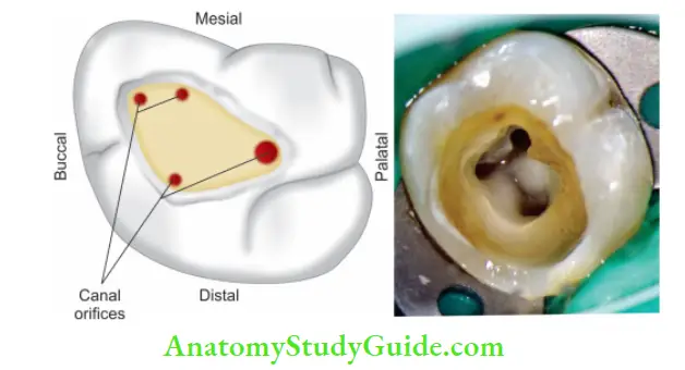 Internal Anatomy Line diagram and mandibular molar showing canal orifies.