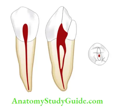 Internal Anatomy Mandibular fist premolar.