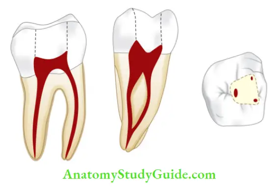 Internal Anatomy Mandibular second molar
