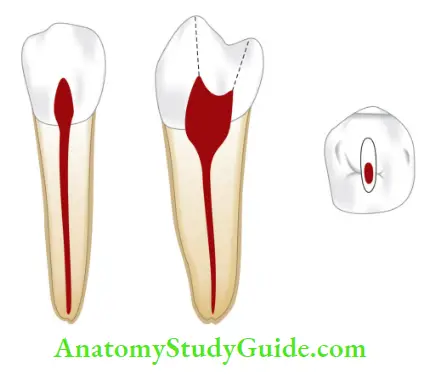 Internal Anatomy Mandibular second premolar