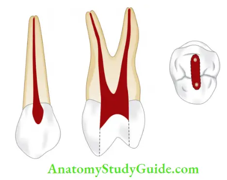 Internal Anatomy Maxillary fist premolar