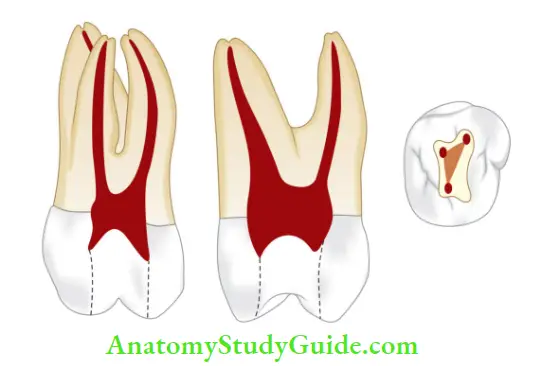 Internal Anatomy Maxillary second molar.