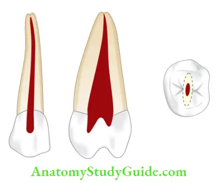 Internal Anatomy Maxillary second premolar