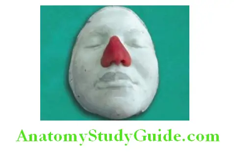 Introduction To Maxillofacial Prosthesis wax pattern of nasal prosthesis