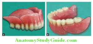 Introduction To Complete Denture Notes - Anatomy Study Guide