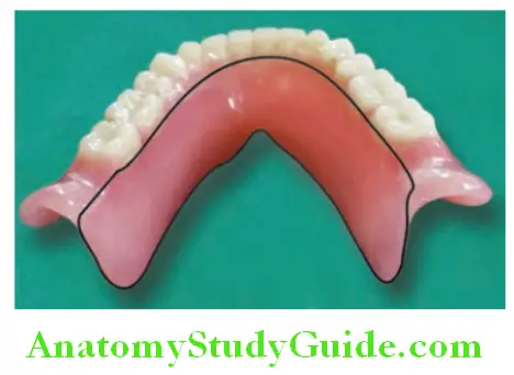 Introduction to Complete Denture lingual flange of mandibular denture
