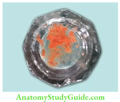 Irrigation And Intracanal Medicaments contact of sodium hypochlorite and chlorhexidine produces an orange–brown precipitate known as parachloroaniline