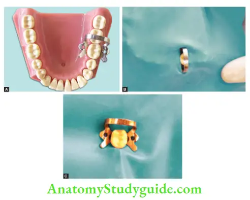 Isolation Of Teeth Placement of rubber dam