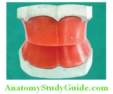 Lines Planes And Curves In Prosthodontics occlusal plane
