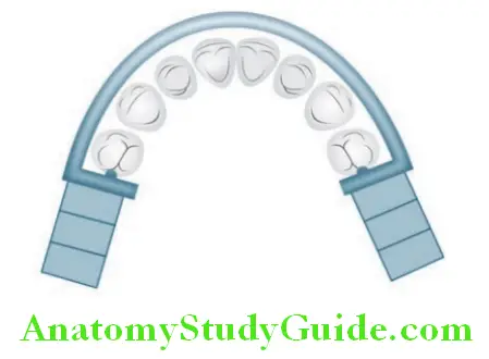 Mandibular Major Connectors mandibular labial bar