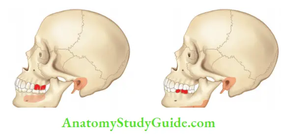 Maxillary second and third molars refer pain to mandibular molar area and seldom in ear;Mandibular fist and second molars refer pain to ear and angle of the mandible.