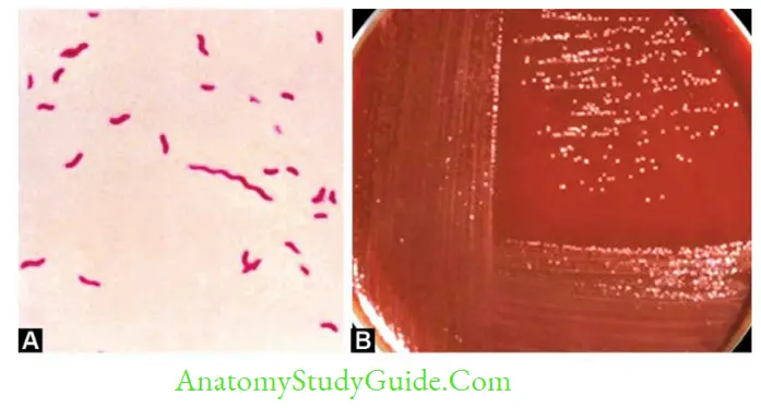 Miscellaneous Bacteria Notes Campylobacter—A. Gram-negative spiral rods;B. Growth on Skirrow's media