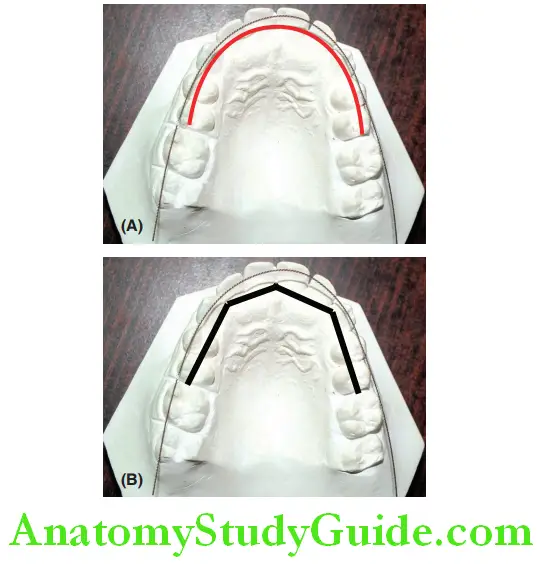 Mixed Dentition Space Analysis Measuring space with a brass wire and four segments to calculate space with dividers