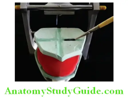 Mounting Occlusal Rims On Articulator application of petroleum jelly in index