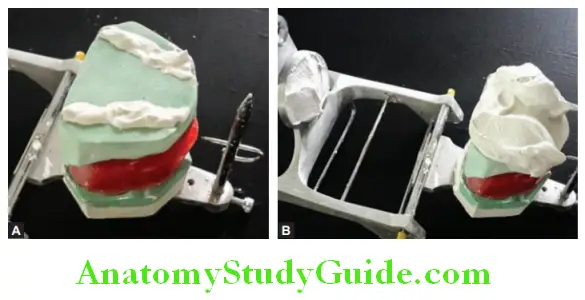 Mounting Occlusal Rims On Articulator apply mounting plaster in index and on base of the cast