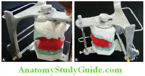 Mounting Occlusal Rims On Articulator close the lower member and shape the mountain plaster