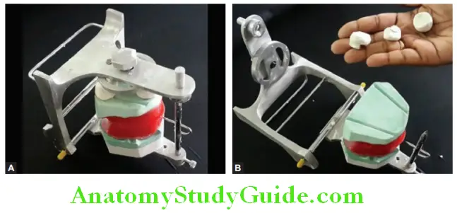 Mounting Occlusal Rims On Articulator invert the articulator for mounting mandibular