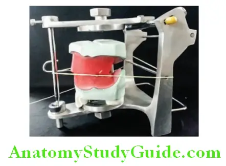 Mounting Occlusal Rims On Articulator matching of two planes at eye level