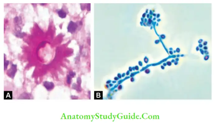 Fungal Infections: Symptoms, Types, And Treatment - Anatomy Study Guide