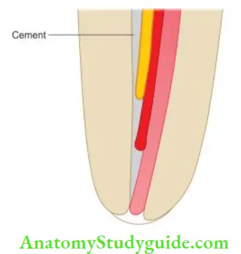 Obturation Of Root Canal System In lateral compaction of gutta-percha, cones never fit as homogeneous mass, sealer occupies the space in between the cones.