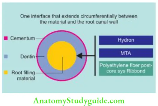 Obturation Of Root Canal System Primary monoblock concept