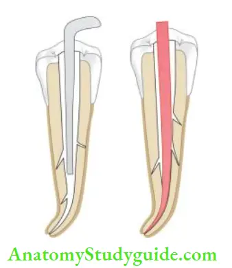 Obturation Of Root Canal System Selection of plugger according to shape and size of the canal; Confirm fit of the cone;