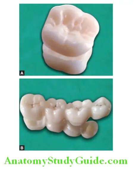 Overview of Prosthodontics all ceramic crown and fixed partial denture
