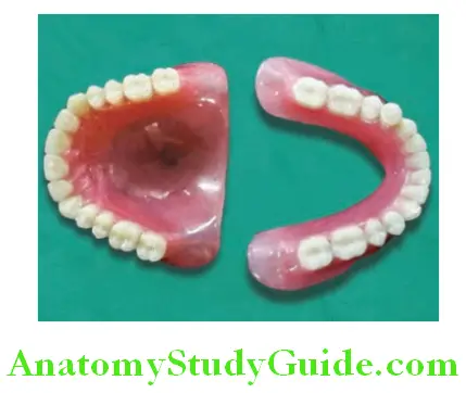 Overview of Prosthodontics complete dentures
