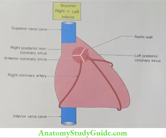 Pericardium And Heart Aortic sinuses showing origin of coronary arteries
