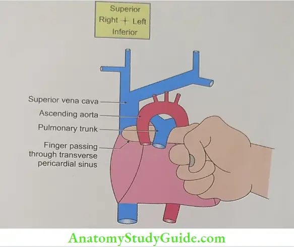 Pericardium And Heart Right index finger showing position of transverse sinus of heart