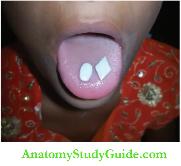 Pernicious Oral Habits Notes Exercise for tongue