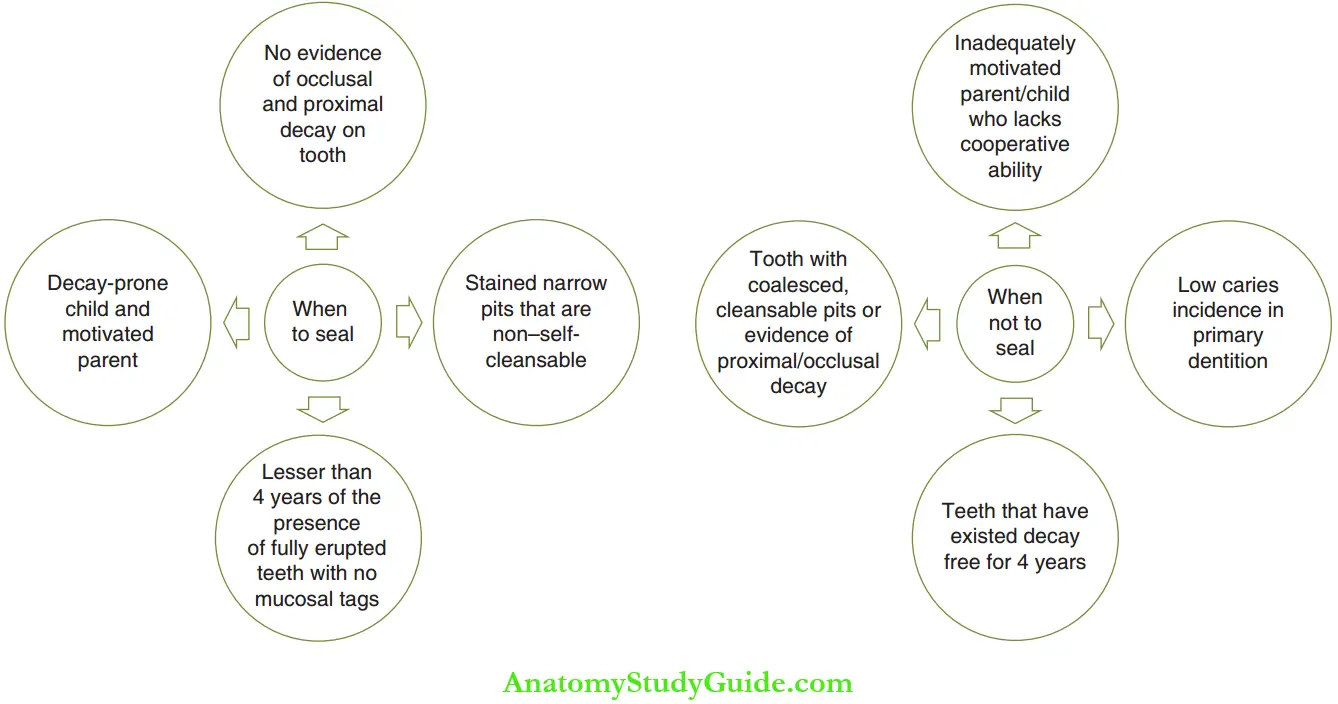 Pit And Fissure Sealants Quick Clinical Guide To Assess Whether The Tooth Needs A Sealant Or Not