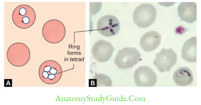 Plasmodium Species And Babesia Giemsa stained blood smear showing Maltese cross form A. Schematic diagram; B. Peripheral blood smear