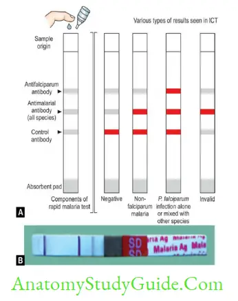 Plasmodium Species And Babesia Schematic diagram of rapid diagnostic test kit showing negative non-falciparam,pure or mixed infection with Plasmodium