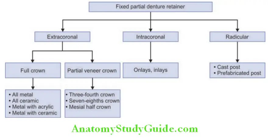 Pontic Retainers And Connectors classification of retainer