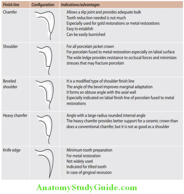 Principles Of Tooth Preparation A Brief Overview finish lines according to shape
