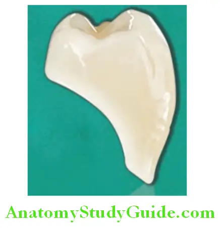 Prosthetic Teeth acrylic tooth