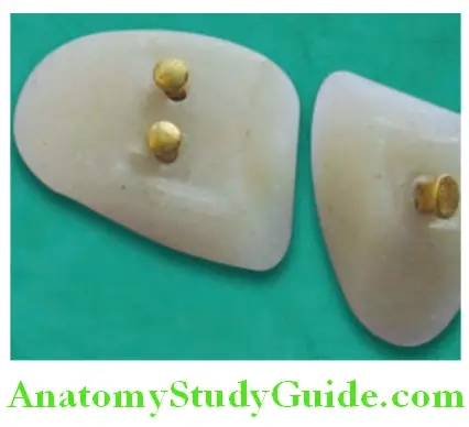 Prosthetic Teeth porcelain teeth with metal pins