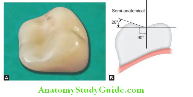 Prosthetic Teeth semi anatomical tooth with 20° cuspal angulation