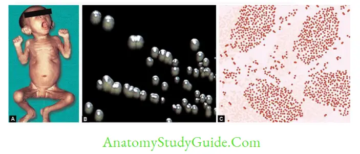 Pseudomonas And Other Nonfermenters And Hsemophilus Bordetella Brucella(HBB) Notes Female infant colonies gram stained smear