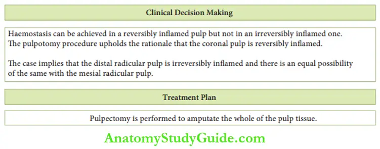 Pulpectomy In Primary Teeth Clinical Decision Making Treatment Plan