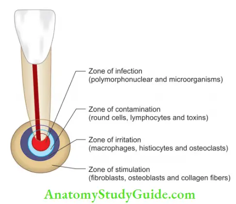 Rationale Of Endodontic Treatment Notes Fish,s Zones