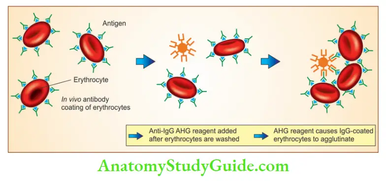 Red Blood Cells and Bleeding Disorders Direct antiglobulin test
