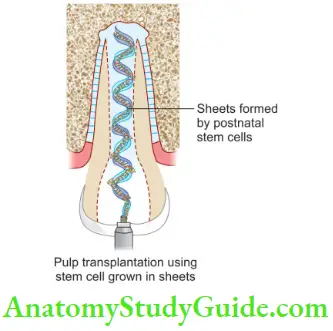 Regenerative Endodontic Pulp Implantation Using Stem Cells Grown In Sheets