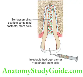 Regenerative Endodontics Postnatal Stem Cell Therapy