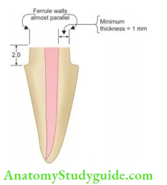 Restoration Of Endodontically Treated Teeth Diagrammatic representation of ferrule effct.