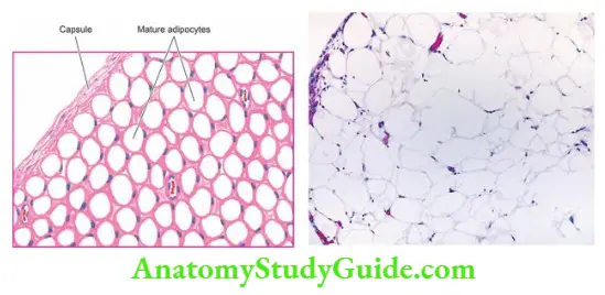 Soft Tissue Tumours Lipoma.