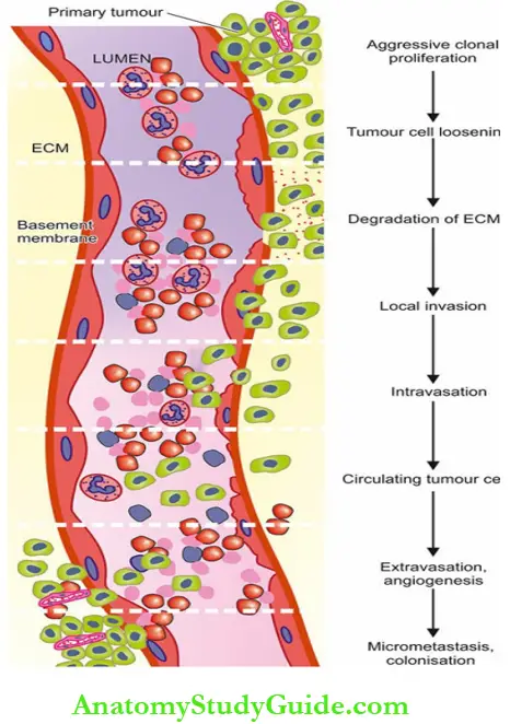 Spread Of Tumours Invasion-Metastasis Cascade